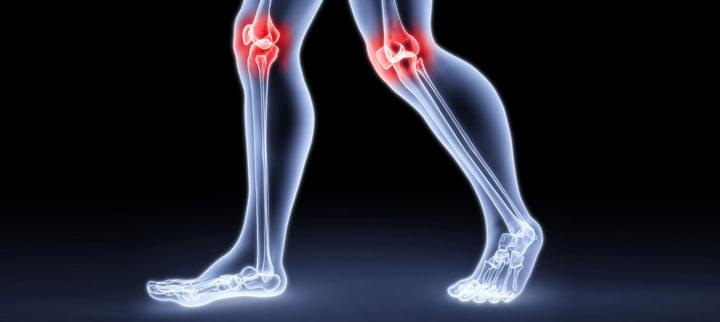 Boka és lábfejfájdalmak - A láb csontok és ízületek károsodása